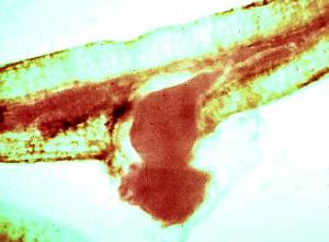 Root-Knot Nematode Female in Root